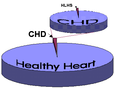 Pie Chart for HLHS frequency - khp